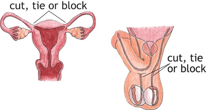 Sterilization